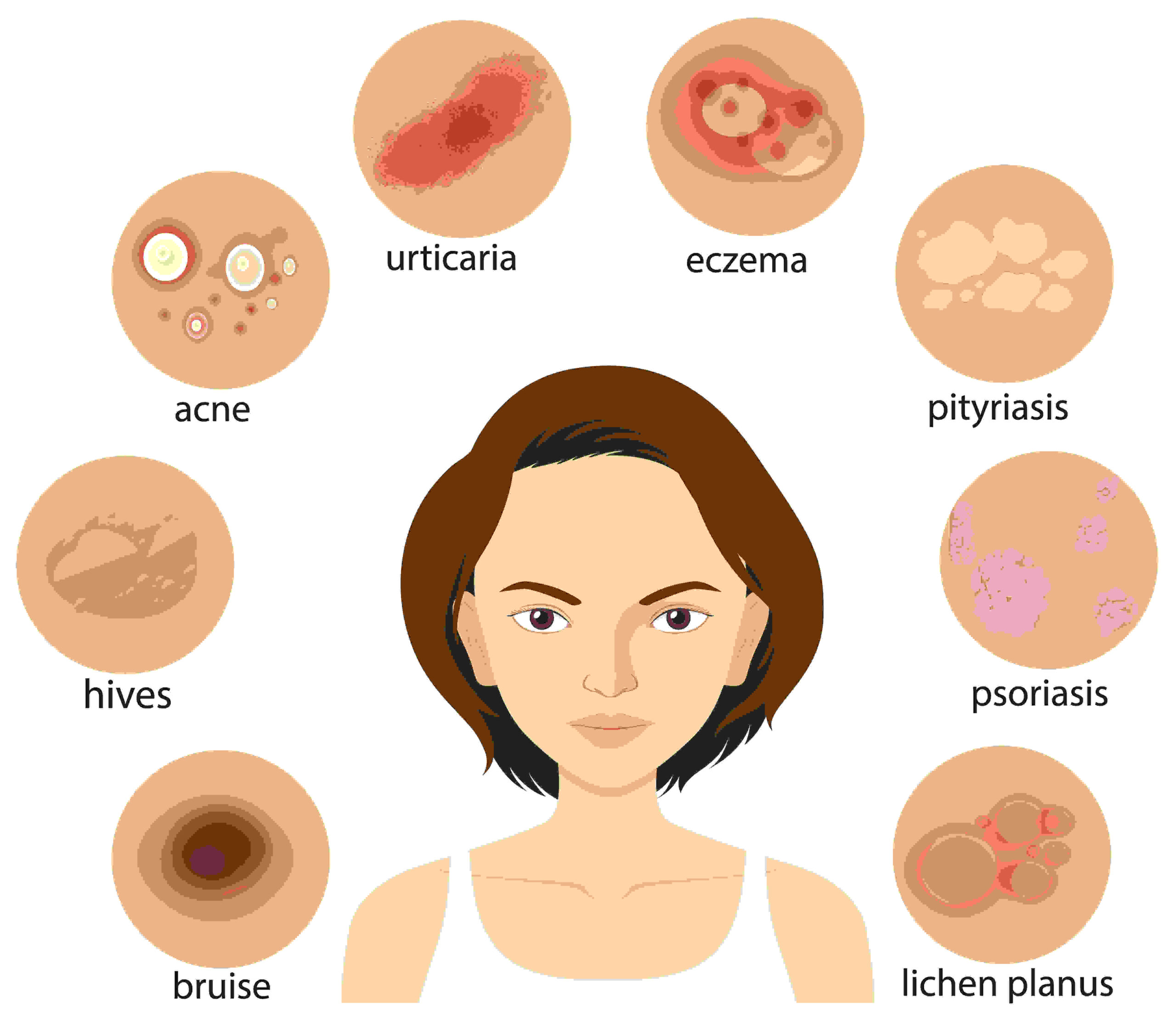 Skin Disease Treatment In Homeopathy
